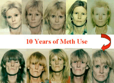 Photo of 10 Years of Meth Use